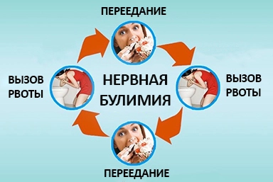 Лечение булимии в Яндаре
